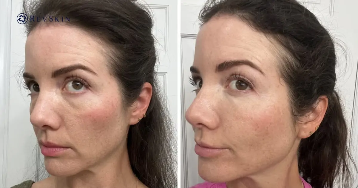 Kết Quả Mong Đợi Theo Từng Giai Đoạn