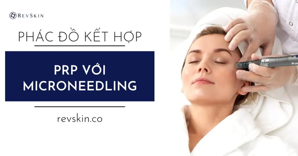 Phác đồ kết hợp PRP và Microneedling