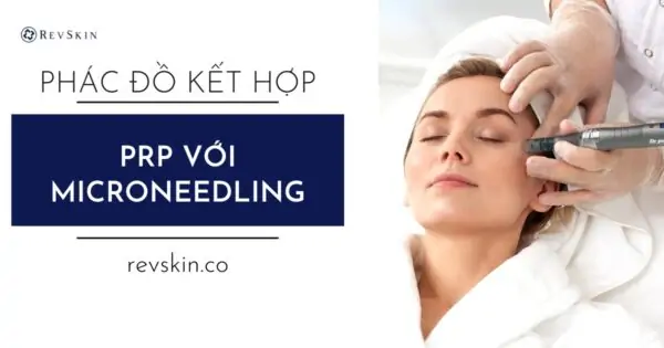 Phác đồ kết hợp PRP và Microneedling
