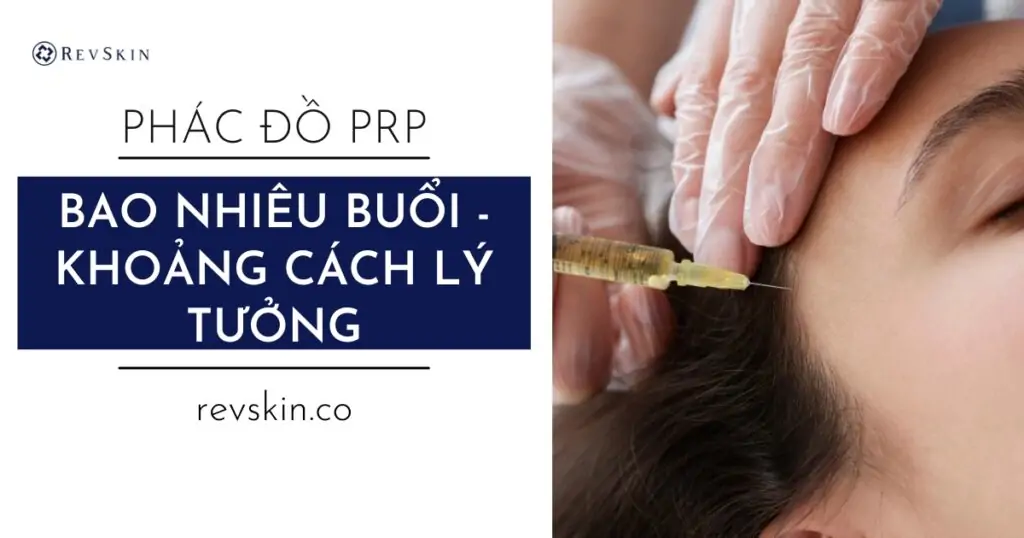 Phác đồ PRP trẻ hoa da chuẩn