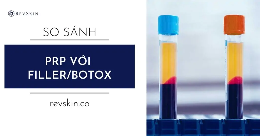 So sánh PRP với Filler